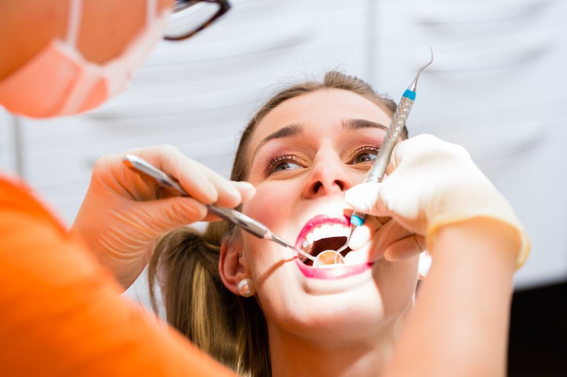 The Deep Dive : Do I Really Need A Deep Teeth Cleaning?