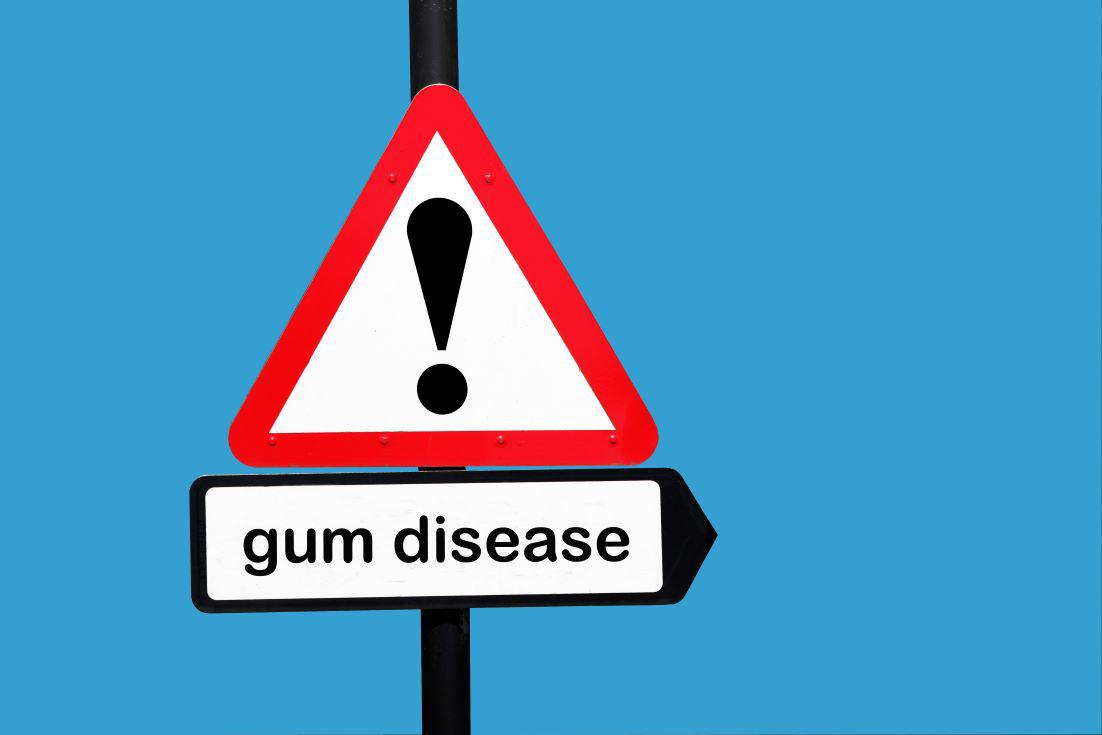 Learn to Spot Signs of Gum Disease